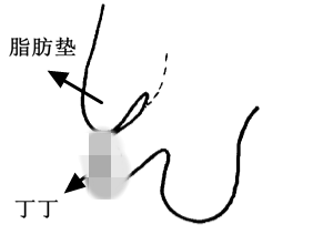 男人的丁丁到底长什么样子的