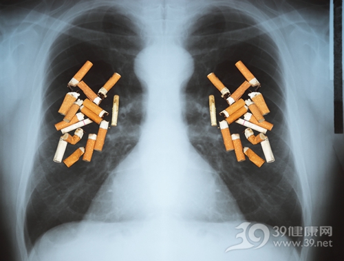 X光片 肺部 抽烟 吸烟 禁烟 无烟日_15688014_xxl